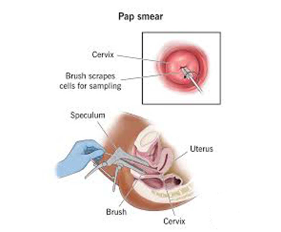  Pap Test